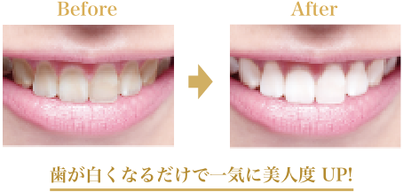 歯が白くなるだけで一気に美人度 UP!